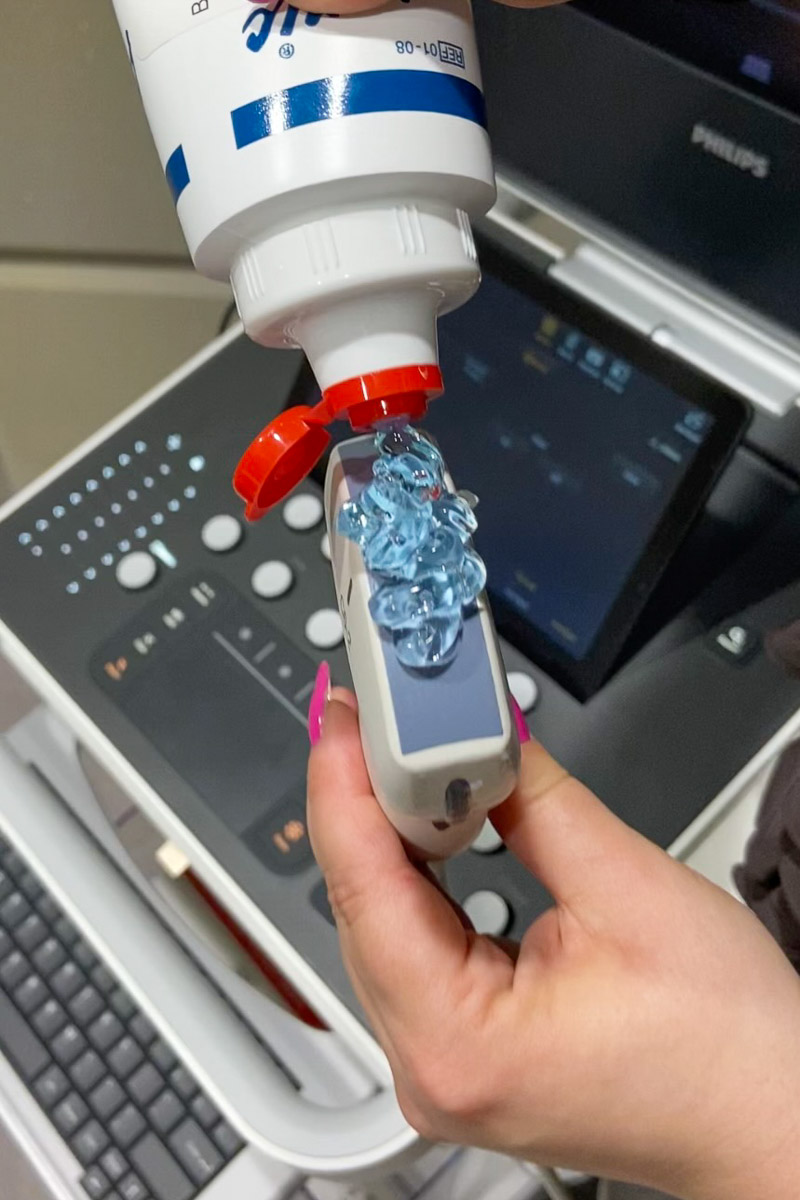 photograph: a person applies some gel to the head of an ultrasound device
